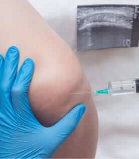 Procedimientos ortopédicos de rodilla